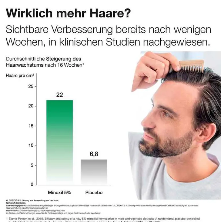 Alopexy 5% Lösung, 3X60 ml