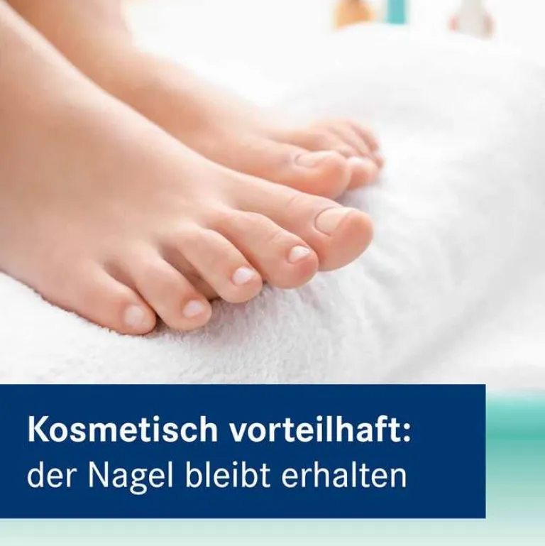 Amorolfin Nagelkur 5 % wirkstoffhaltiger Nagellack, 5 ml Nagelpilz Lack