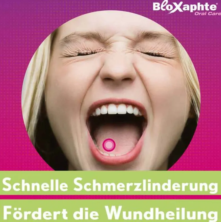 Best Bloxaphte ® Oral Care Mundspray bei Aphthen und Verletzungen im Mund, 20 ml