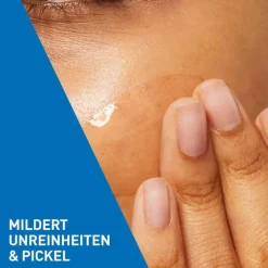 Outlet CeraVe Anti-Unreinheiten Gel, 40 ml