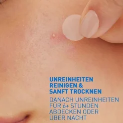 Sale Anti-Unreinheiten Patches, 22 St Unreine Haut|Hauttypen