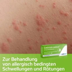 Online Cetirizin ® 10 mg Filmtabletten, 7 St Cetirizin|Allergie Tabletten