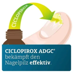 Sale ADGC CICLOPIROX ® 80 mg/g wirkstoffhaltiger Nagellack, 3.3 ml