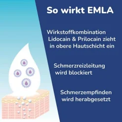Emla Creme + Tegaderm Pflaster, 5X5 g