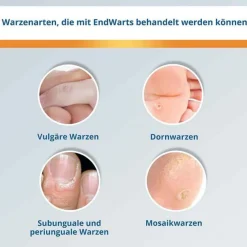 Hot Endwarts ® CLASSIC Lösung, 3 ml