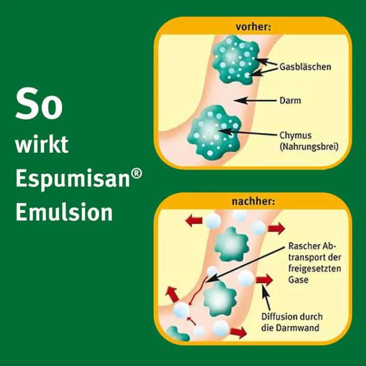 Espumisan Emulsion, 30 ml