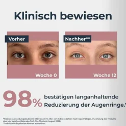 Clearance Anti-Pigment Augenpflege Augenringe, 15 ml Augenpflege