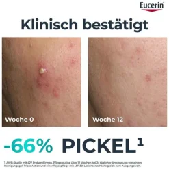 Clearance Dermopure Clinical Triple Action Creme, 40 ml Unreine Haut|Hauttypen