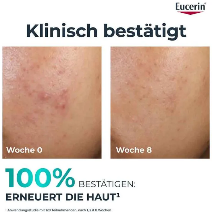 Eucerin Dermopure Clinical Peeling 10 Nachtcreme, 40 ml
