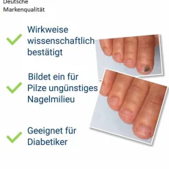 Sale Anti-Nagelpilz liquid, 10 ml Nagelpilz Lack