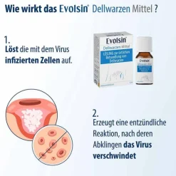 Evolsin Dellwarzen Mittel Lösung, 5 ml