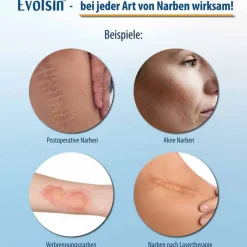 Sale Evolsin Narbenpflaster 2,5cm x 200cm, 1 St