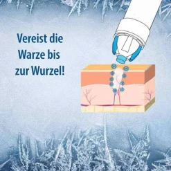 Evolsin® Warzenvereiserspray, 75 ml