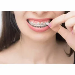 Best Orthodontisches Wachs, 1 St Geräte & Zubehör