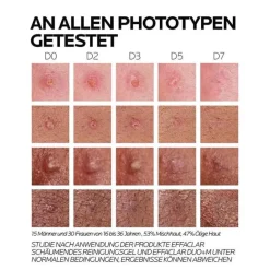 Discount Effaclar Duo + M Creme, 40 ml Unreine Haut|Hauttypen