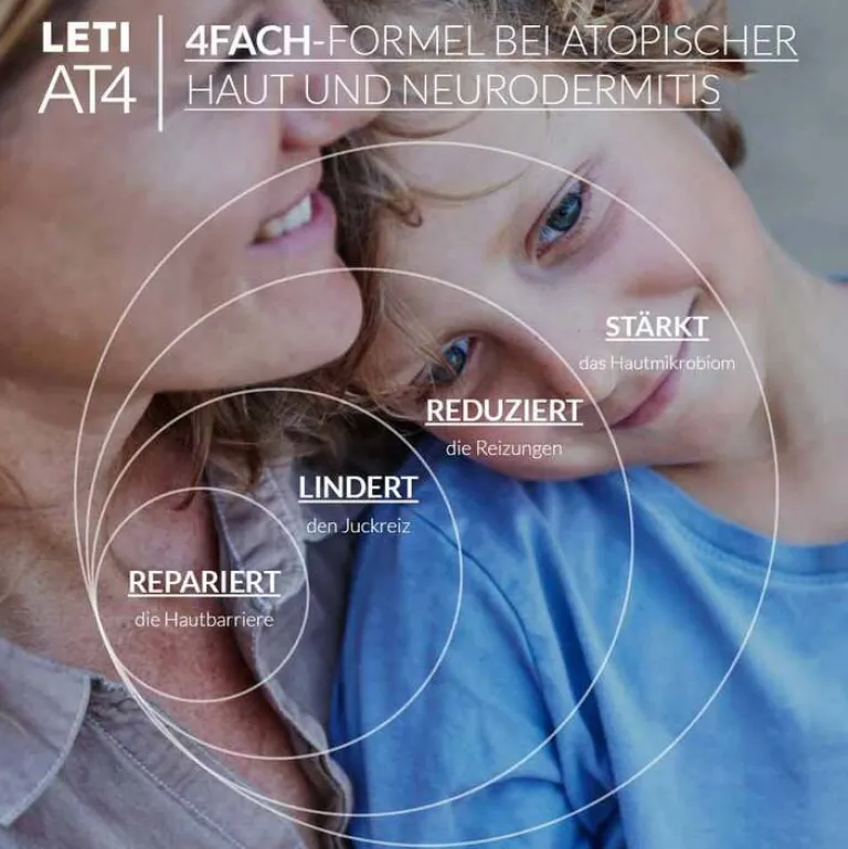 Online AT4 Intensivcreme, 100 ml Trockene & Sensible Haut|Neurodermitis Basispflege