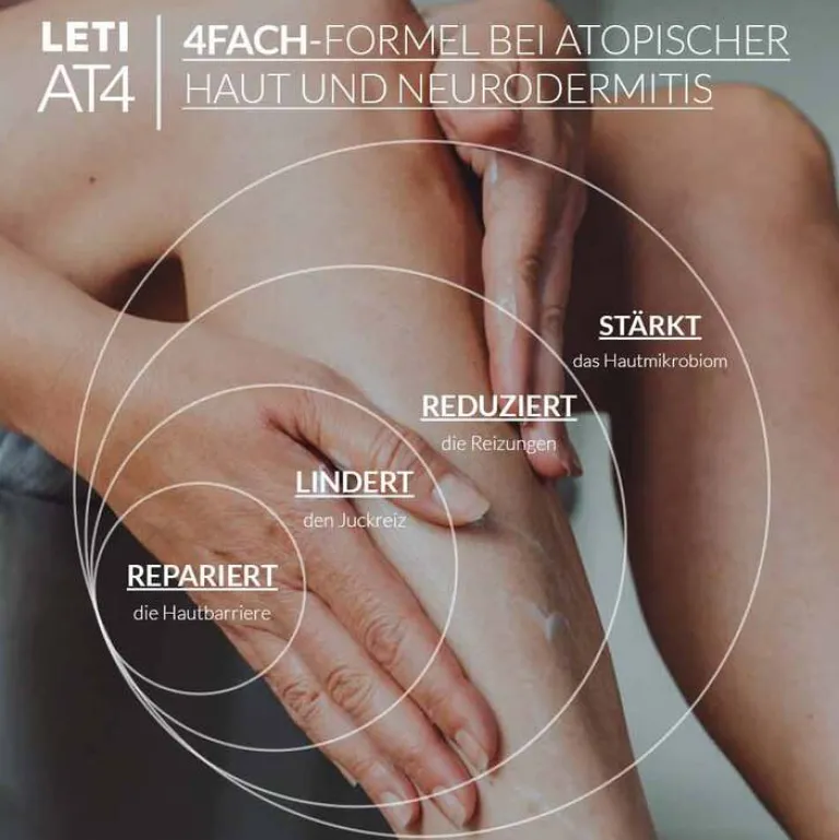 Online AT4 Körpercreme, 200 ml Neurodermitis Basispflege|Trockene Haut