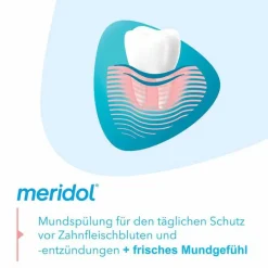 Sale Mundspül Lösung, 400 ml Mundspülung