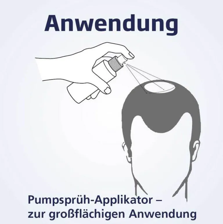 Sale Minoxicutan ® Männer 50 mg/ml Spray, 3X60 ml