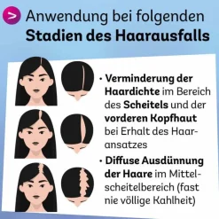 Minoxidil Dexcel 20 mg / ml Spray z.Anw.a.d.Kopfhaut, 60 ml