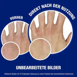 Discount Neutrogena norwegische Formel Konzentrat Handcreme parfümiert, 75 ml