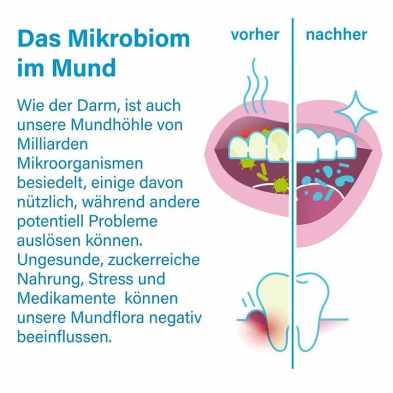 Online probadent lemon Mundflora Lutschtabletten, 30 St Bakterienkulturen