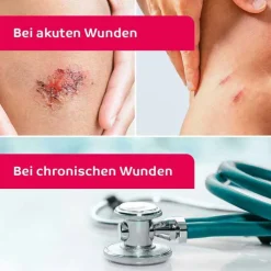 octenisept Wund-Desinfektion Spray mit Sprühpumpe, 50 ml