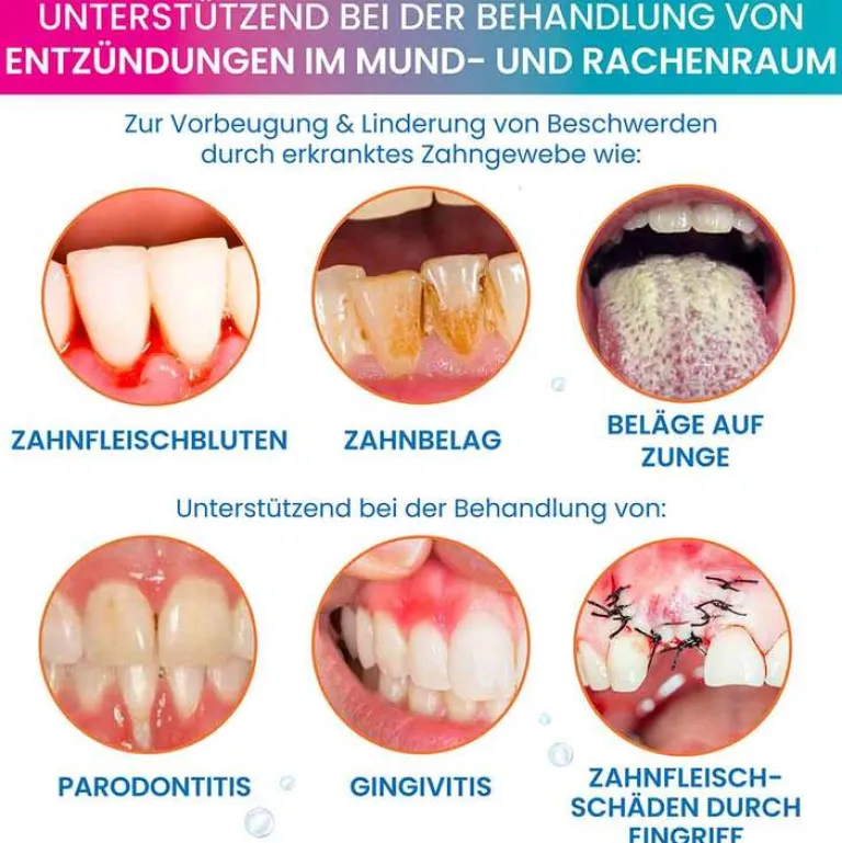 Clearance Oroxid Forte Mundspüllösung, 250 ml
