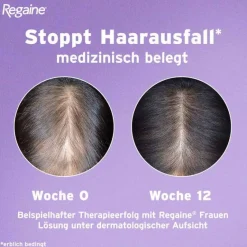 Clearance Frauen Schaum 50 mg/g, 2X60 g Mittel Gegen Haarausfall