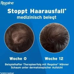 Hot Regaine Männer Schaum 5%, 3X60 ml