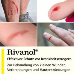 Rivanol Lösung 0,1 %, 100 ml
