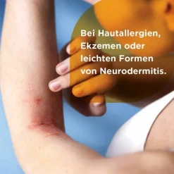 Soventol® HydroCort 0,5% Creme bei akuten Hautentzündungen, 30 g