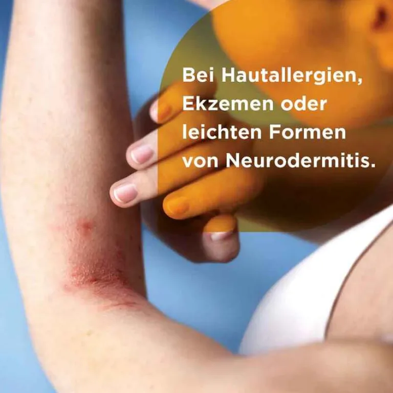 Outlet Soventol ® HydroCort 0,5% Creme bei akuten Hautentzündungen, 15 g