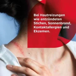 ® HydroCortisonacetat 0,5% Cremogel bei Hautentzündungen, 30 g Mittel Gegen Sonnenbrand|Allergie Medikamente
