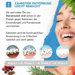 New oral Zahnstein Spray, 65 ml Mundpflege