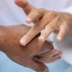 Phametra Urea / Harnstoffsalbe 10% ig, 250 g