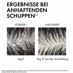 Outlet Dercos Anti-Schuppen Shampoo trockene Kopfhaut , 500 ml Haarausfall & Schuppen