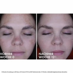 Sale Liftactiv B3 Retinol Nachtcreme, 50 ml Nachtpflege|Hautbedürfnisse