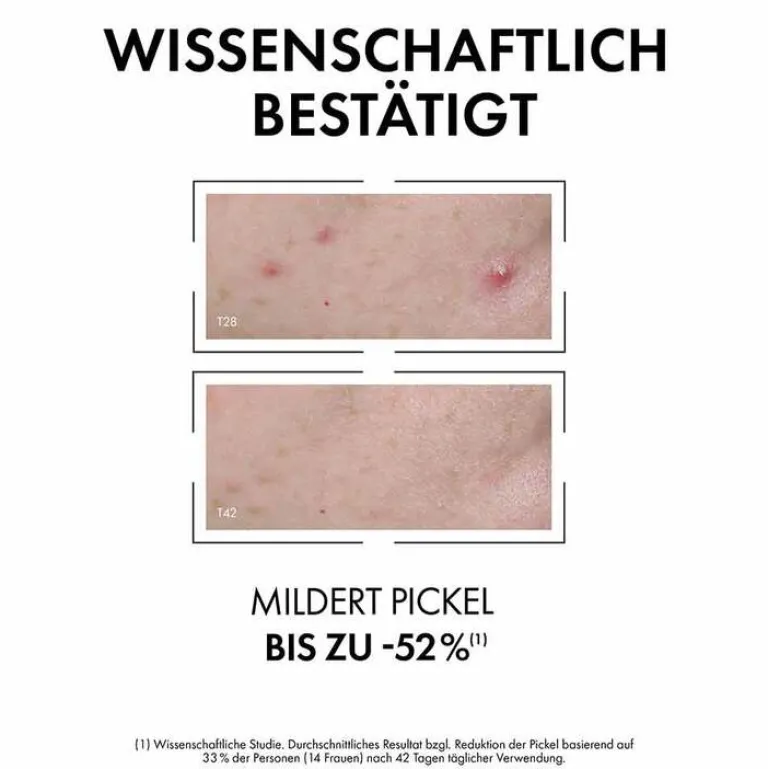 Hot Normaderm Anti-Unreinheiten Serum, 30 ml Unreine Haut|Serum & Kur